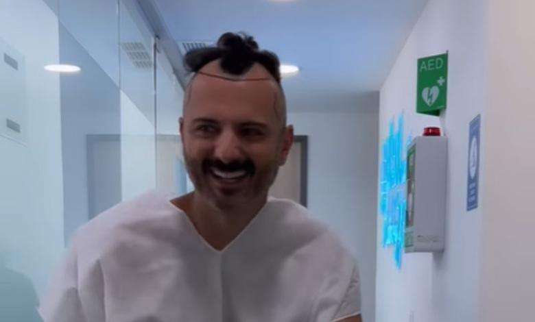 Mario Espitia se hizo implante capilar