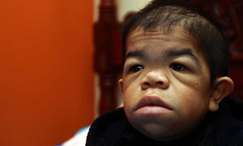 Edward Niño, el colombiano que vuelve a ser el hombre más bajo del mundo
