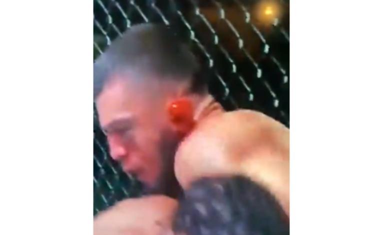 Peleador de UFC casi pierde una oreja