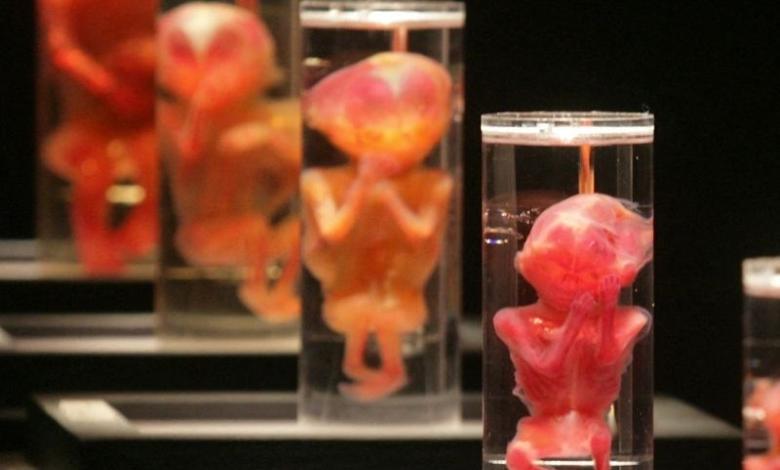 Terrorífica experiencia de dos estudiantes en el laboratorio de biología: encontraron fetos humanos