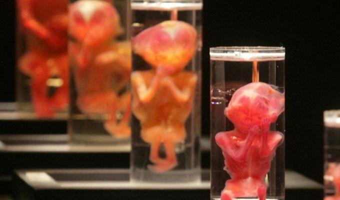 Terrorífica experiencia de dos estudiantes en el laboratorio de biología: encontraron fetos humanos